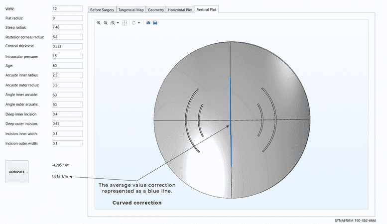 Vertical axis