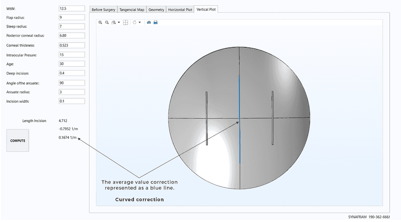 Vertical axis