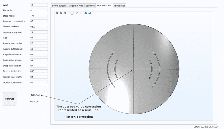 Horizontal axis