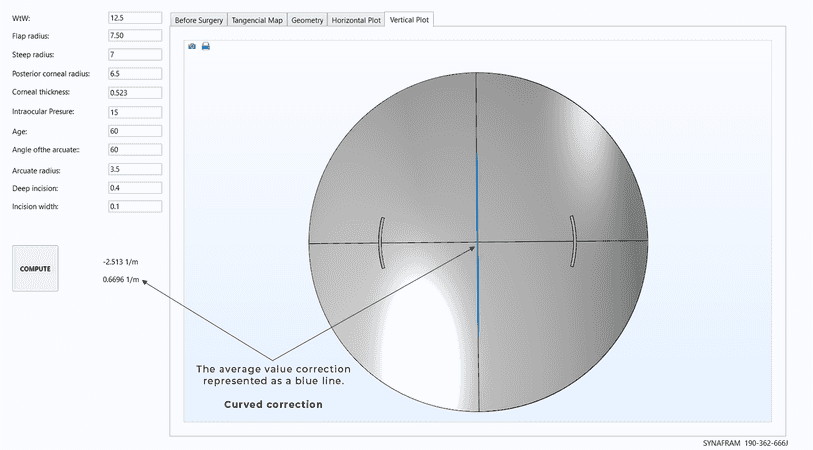 Vertical axis