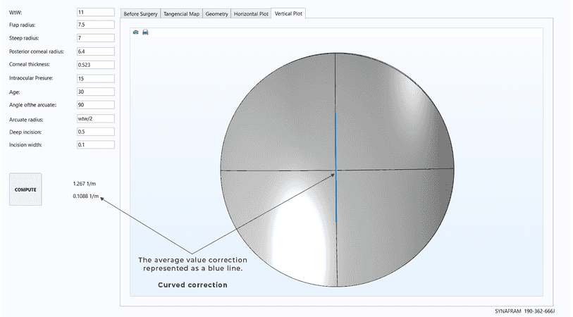 Vertical axis